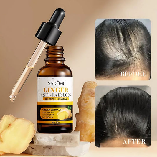 GingerRoot+ | Serum Capilar Regenerador