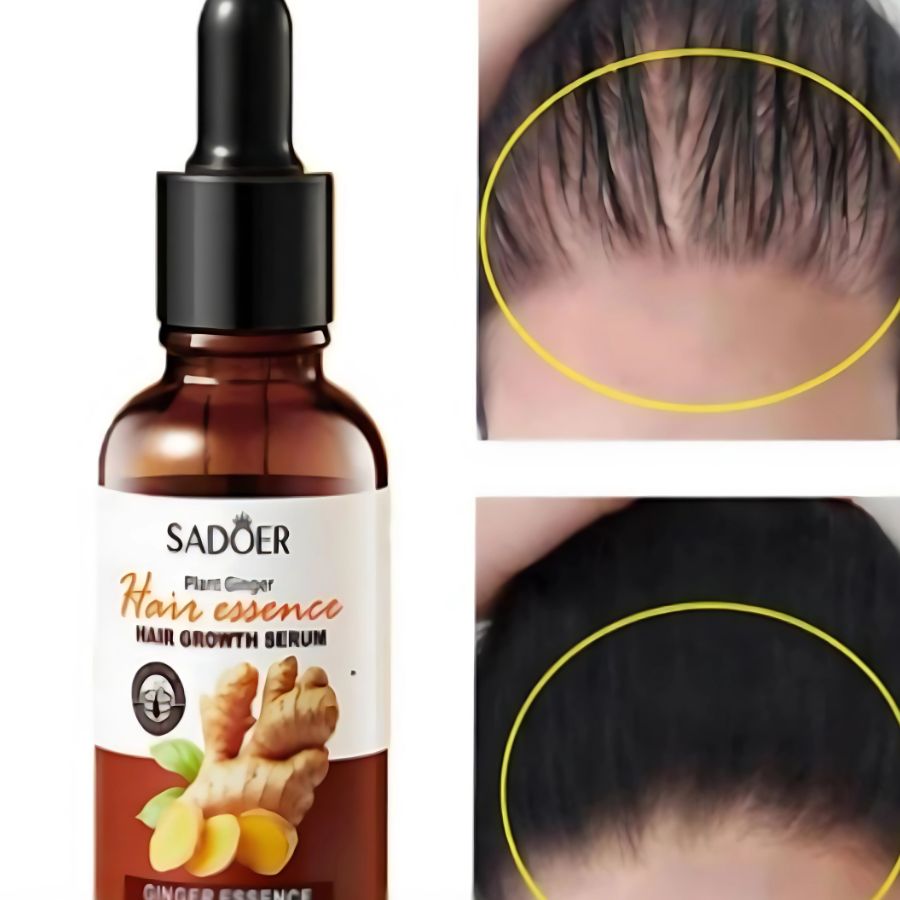 GingerRoot+ | Serum Capilar Regenerador