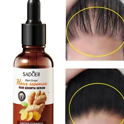 GingerRoot+ | Serum Capilar Regenerador